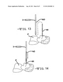 Endotracheal tube exchanger and detachable stylet assembly therefor diagram and image