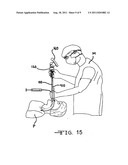 Endotracheal tube exchanger and detachable stylet assembly therefor diagram and image