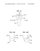 Medical Devices and Methods diagram and image