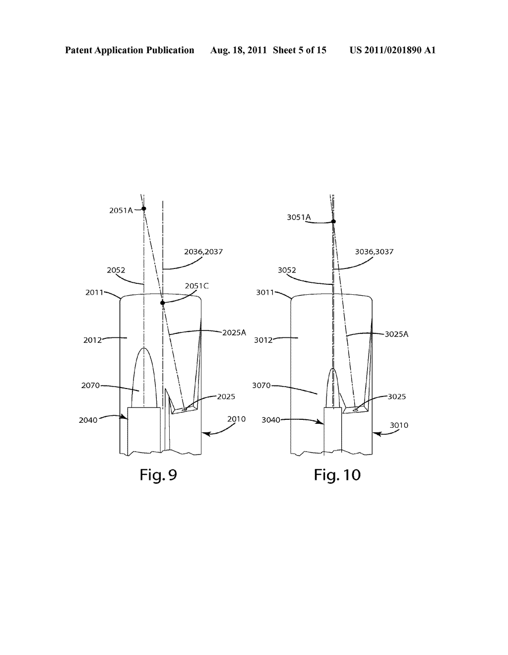 LARYNGOSCOPE GUIDE AND RELATED METHOD OF USE - diagram, schematic, and image 06