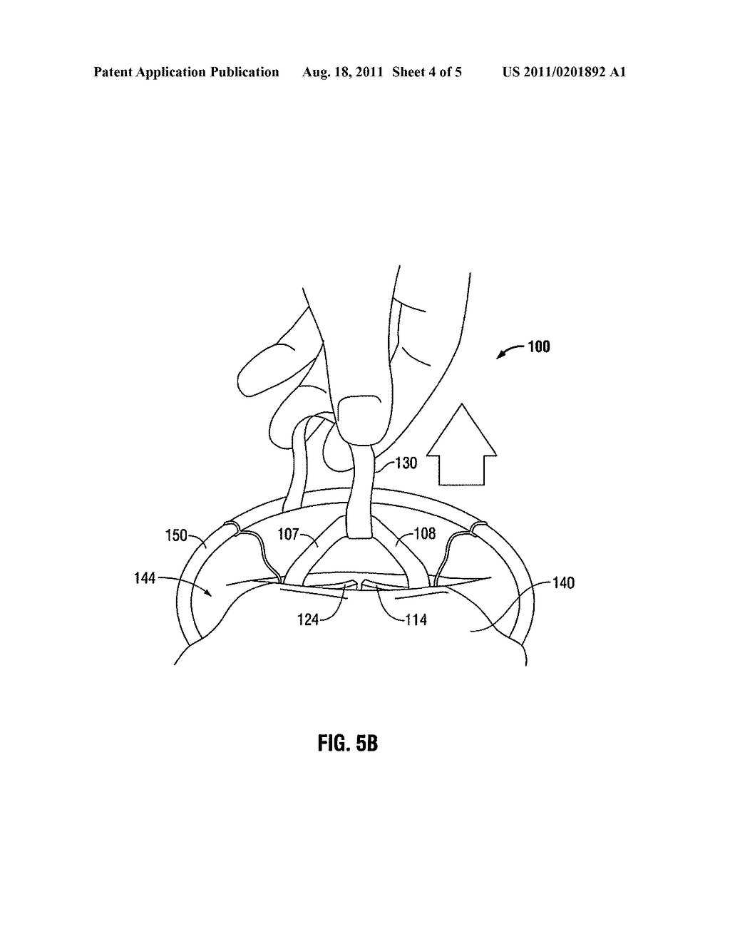 EXPANDABLE THORACIC ACCESS PORT - diagram, schematic, and image 05