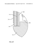 TANK FILTERS PLACED IN SERIES WITH THE LEAD WIRES OR CIRCUITS OF ACTIVE     MEDICAL DEVICES TO ENHANCE MRI COMPATIBILITY diagram and image