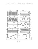 TANK FILTERS PLACED IN SERIES WITH THE LEAD WIRES OR CIRCUITS OF ACTIVE     MEDICAL DEVICES TO ENHANCE MRI COMPATIBILITY diagram and image