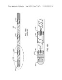 TANK FILTERS PLACED IN SERIES WITH THE LEAD WIRES OR CIRCUITS OF ACTIVE     MEDICAL DEVICES TO ENHANCE MRI COMPATIBILITY diagram and image