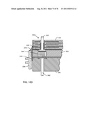 TANK FILTERS PLACED IN SERIES WITH THE LEAD WIRES OR CIRCUITS OF ACTIVE     MEDICAL DEVICES TO ENHANCE MRI COMPATIBILITY diagram and image