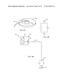 TANK FILTERS PLACED IN SERIES WITH THE LEAD WIRES OR CIRCUITS OF ACTIVE     MEDICAL DEVICES TO ENHANCE MRI COMPATIBILITY diagram and image