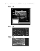 Reflection-Mode Photoacoustic Tomography Using A Flexibly-Supported     Cantilever Beam diagram and image