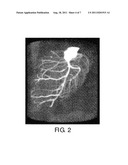 CARDIAC AND OR RESPIRATORY GATED IMAGE ACQUISITION SYSTEM AND METHOD FOR     VIRTUAL ANATOMY ENRICHED REAL TIME 2D IMAGING IN INTERVENTIONAL     RADIOFREQUENCY ABLATION OR PACE MAKER REPLACEMENT PROCECURE diagram and image
