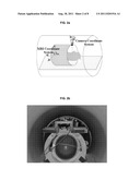 MOVEMENT CORRECTION IN MRI USING A CAMERA diagram and image