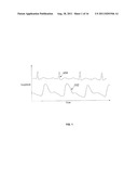 REDUCING DATA ACQUISITION, POWER AND PROCESSING FOR HEMODYNAMIC SIGNAL     SAMPLING diagram and image