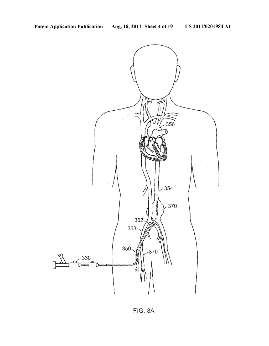 Medical Device Applications of Nanostructured Surfaces - diagram, schematic, and image 05