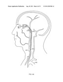 Medical Device Applications of Nanostructured Surfaces diagram and image