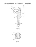 Medical Device Applications of Nanostructured Surfaces diagram and image