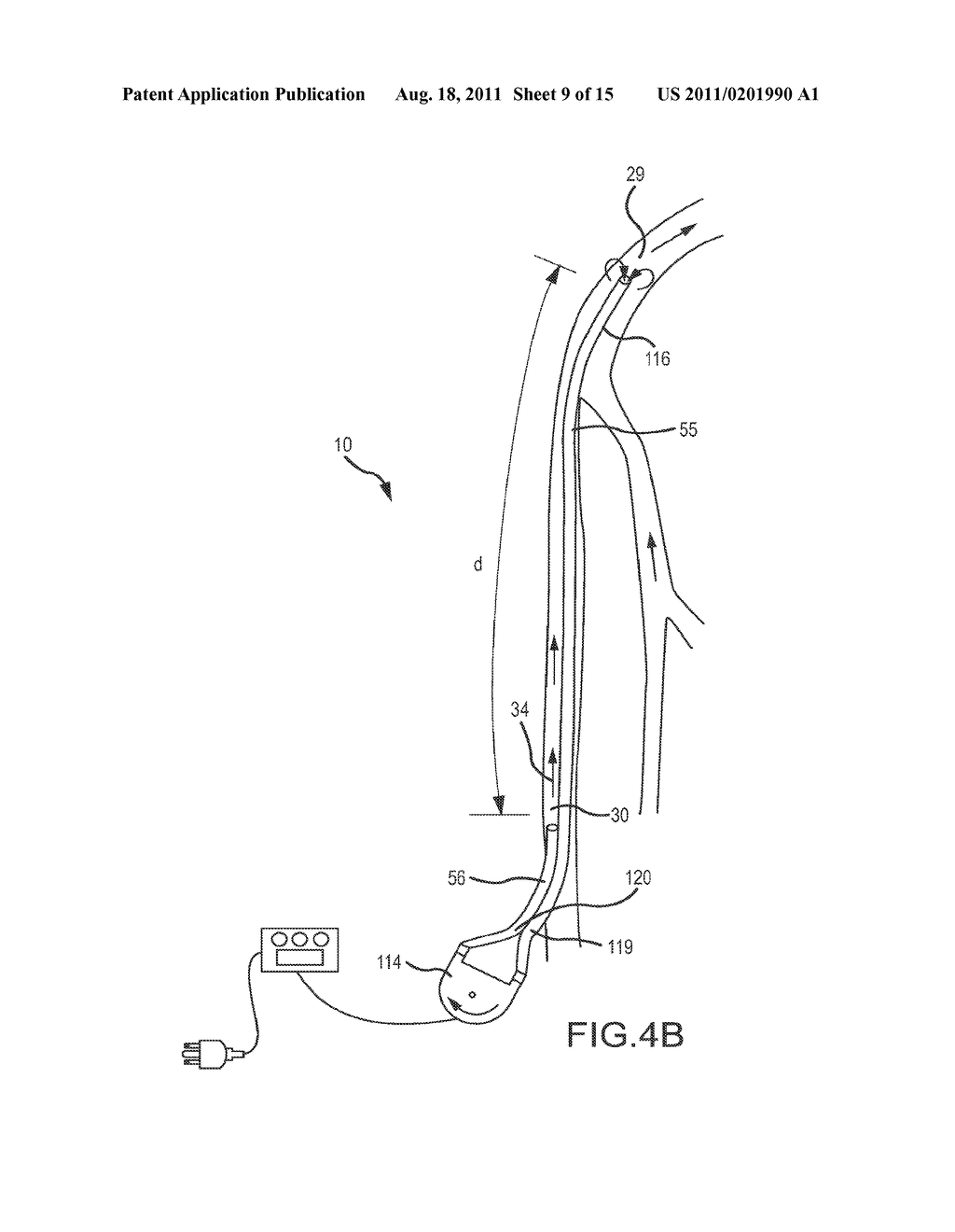 SYSTEM AND METHOD TO INCREASE THE OVERALL DIAMETER OF VEINS - diagram, schematic, and image 10