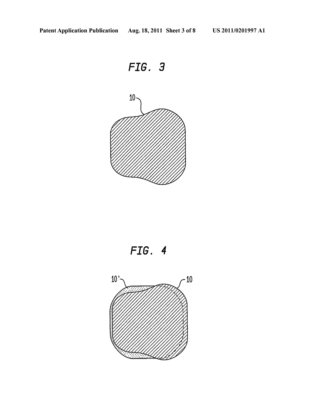 COCHLEAR IMPLANT ELECTRODE LEAD HAVING A CROSS-SECTION WITH VARIABLE     HEIGHT - diagram, schematic, and image 04