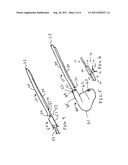 FLUID DELIVERY CATHETER APPARATUS diagram and image