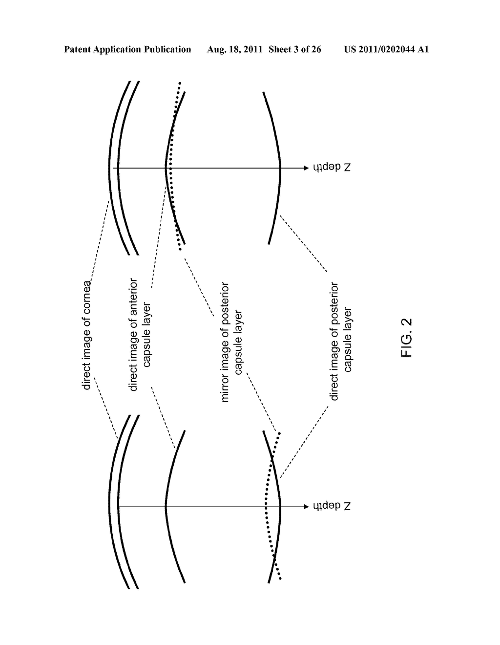 Optical Coherence Tomographic System for Ophthalmic Surgery - diagram, schematic, and image 04