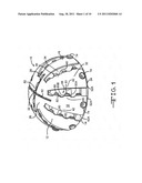 Disposable Reamer diagram and image