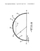 Disposable Reamer diagram and image