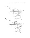 DEVICES AND METHODS FOR DEPLOYING MEDICAL SUTURES diagram and image