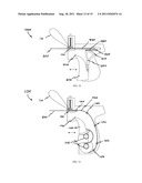 DEVICES AND METHODS FOR DEPLOYING MEDICAL SUTURES diagram and image