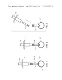 Temporary Anastomotic Seal and Method diagram and image