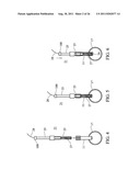 Temporary Anastomotic Seal and Method diagram and image