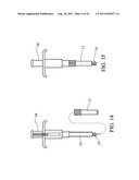 Temporary Anastomotic Seal and Method diagram and image