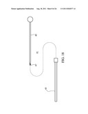 Temporary Anastomotic Seal and Method diagram and image