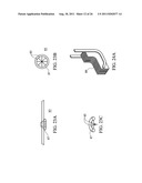 Temporary Anastomotic Seal and Method diagram and image