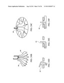 Temporary Anastomotic Seal and Method diagram and image