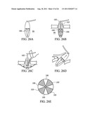 Temporary Anastomotic Seal and Method diagram and image