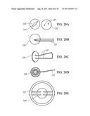 Temporary Anastomotic Seal and Method diagram and image