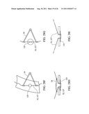 Temporary Anastomotic Seal and Method diagram and image