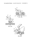 Temporary Anastomotic Seal and Method diagram and image