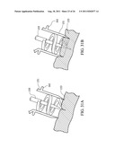 Temporary Anastomotic Seal and Method diagram and image