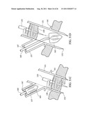 Temporary Anastomotic Seal and Method diagram and image