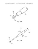 Temporary Anastomotic Seal and Method diagram and image