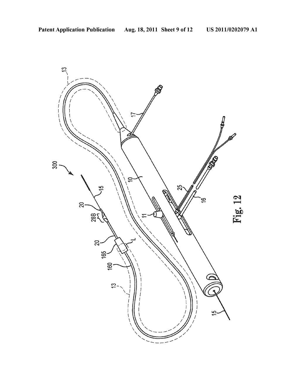 THERAPEUTIC AGENT DELIVERY SYSTEM, DEVICE AND METHOD FOR LOCALIZED     APPLICATION OF THERAPEUTIC SUBSTANCES TO A BIOLOGICAL CONDUIT - diagram, schematic, and image 10