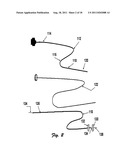 Embolectomy Device With Optional Vibrator diagram and image