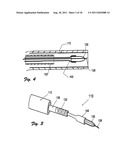 Embolectomy Device With Optional Vibrator diagram and image