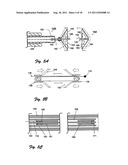 Embolectomy Device With Optional Vibrator diagram and image