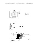 Embolectomy Device With Optional Vibrator diagram and image