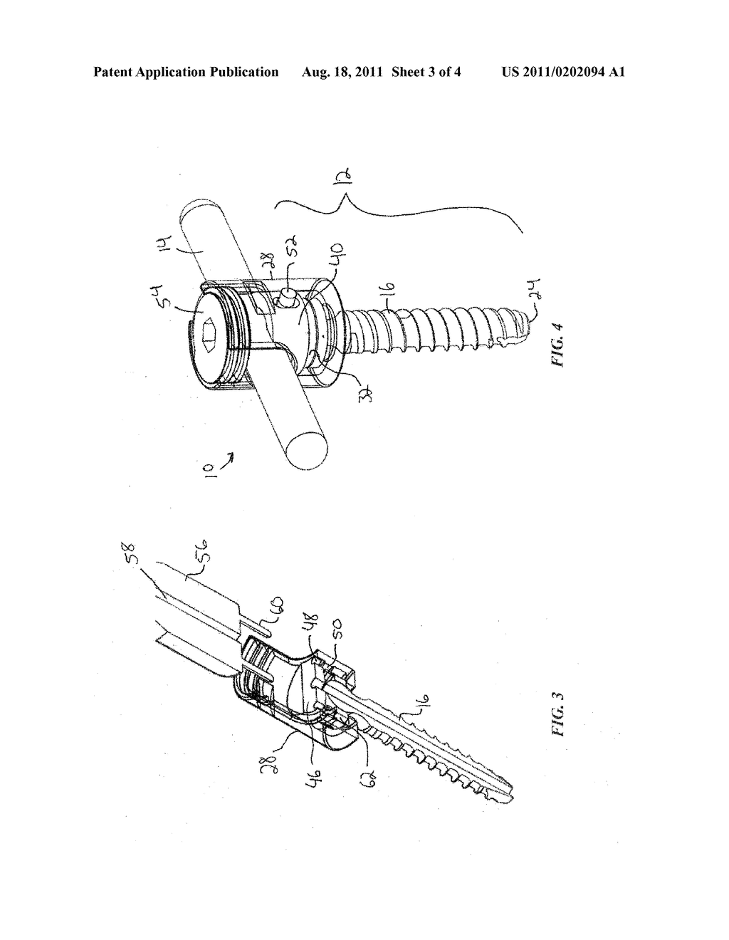 TRANS-POLYAXIAL SCREW - diagram, schematic, and image 04