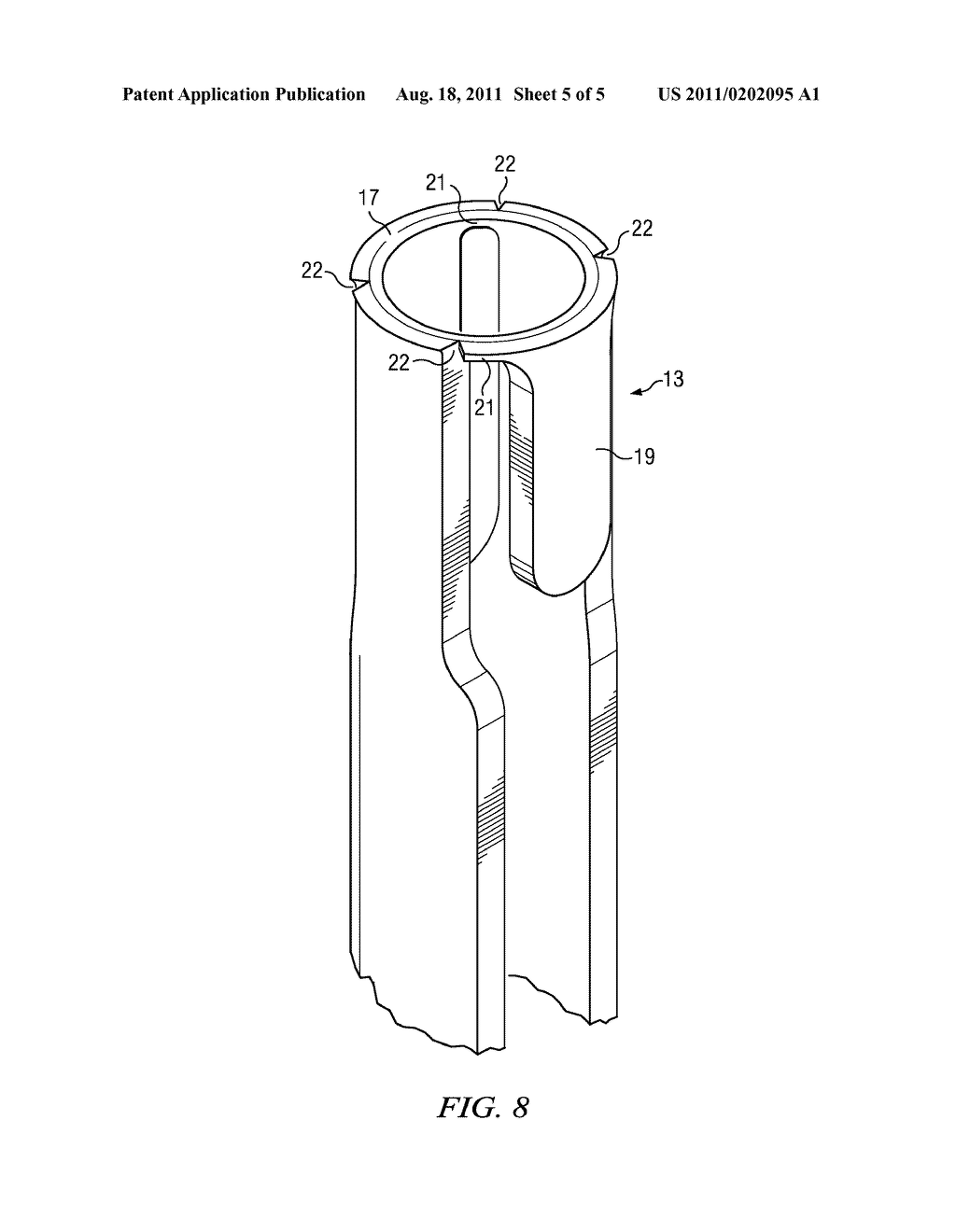 ANTI-SPLAY APPARATUS - diagram, schematic, and image 06