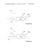 METHODS AND APPARATUS FOR PULSED ELECTRIC FIELD NEUROMODULATION VIA AN     INTRA-TO-EXTRAVASCULAR APPROACH diagram and image