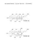 METHODS AND APPARATUS FOR PULSED ELECTRIC FIELD NEUROMODULATION VIA AN     INTRA-TO-EXTRAVASCULAR APPROACH diagram and image