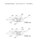 METHODS AND APPARATUS FOR PULSED ELECTRIC FIELD NEUROMODULATION VIA AN     INTRA-TO-EXTRAVASCULAR APPROACH diagram and image