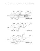 METHODS AND APPARATUS FOR PULSED ELECTRIC FIELD NEUROMODULATION VIA AN     INTRA-TO-EXTRAVASCULAR APPROACH diagram and image