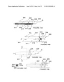 METHODS AND APPARATUS FOR PULSED ELECTRIC FIELD NEUROMODULATION VIA AN     INTRA-TO-EXTRAVASCULAR APPROACH diagram and image